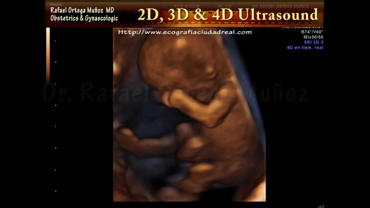4d pregnancy ultrasound